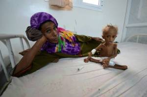 A woman rests on a bed next to her malnourished son at a hospital in the Red Sea port city of Houdieda, Yemen. Meanwhile, a U.S. Navy-backed blockade of Yemen’s ports has left much of the country, the poorest in the Arab world, “on the brink of famine. Reuters